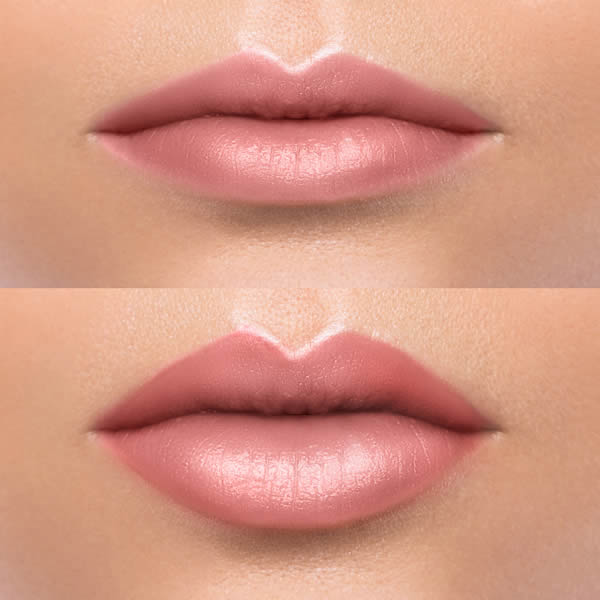 labios rvclinic