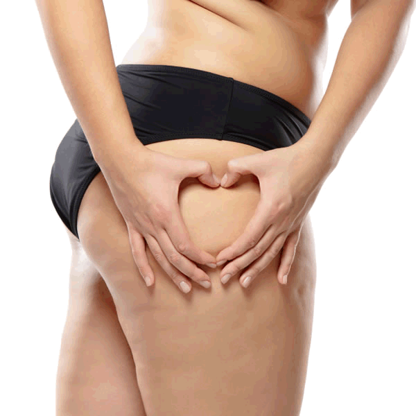 Celulitis2trans